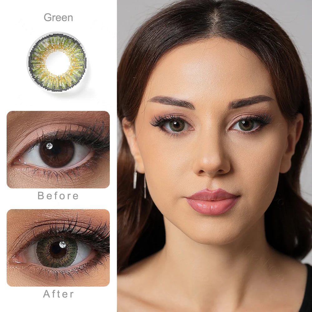 3 tone Green 14.5mm